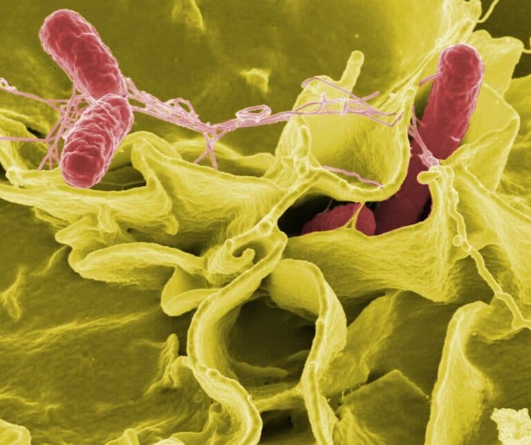 Bakteri Salmonella, Si Penyebab Penyakit Tifus